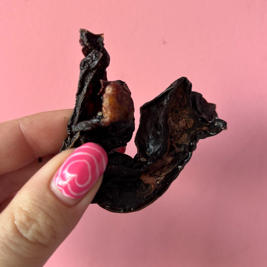 You’re kidney-ing me!